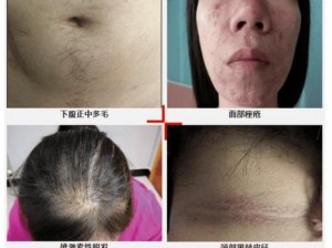 女人丰滿的多毛大陰唇—女人丰满的多毛大阴唇是正常的生理特征吗？