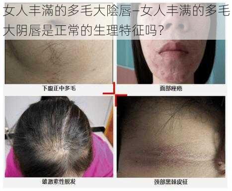 女人丰滿的多毛大陰唇—女人丰满的多毛大阴唇是正常的生理特征吗？